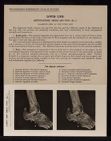 Lower Limb. Articulations, Ankle and Foot - no. 1
